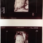 【4D】双子の4Dエコー写真。双子妊娠31w6d